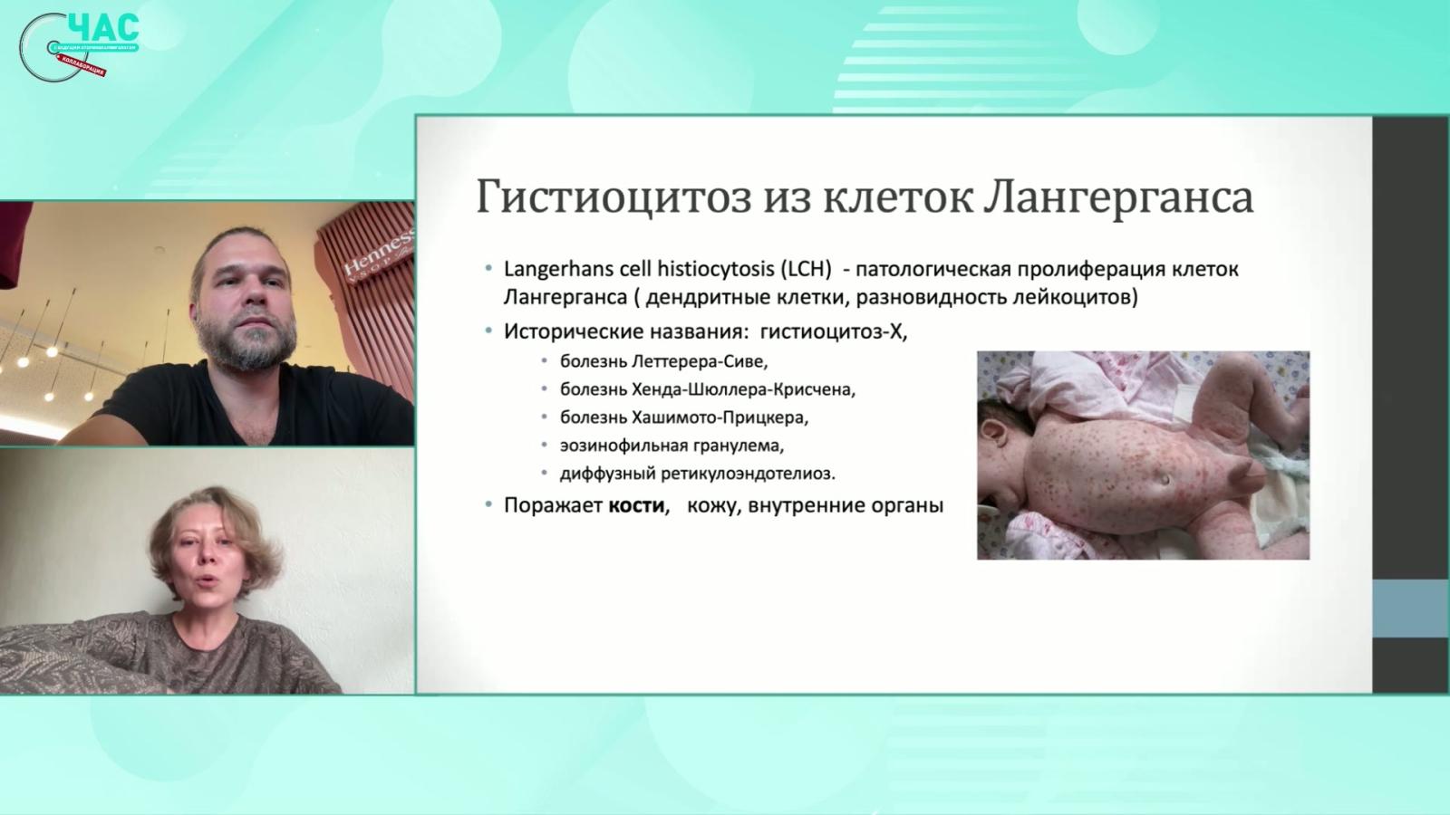 Калинина М.П. - Маски онкогематологических заболеваний в работе оториноларинголога. Продолжение