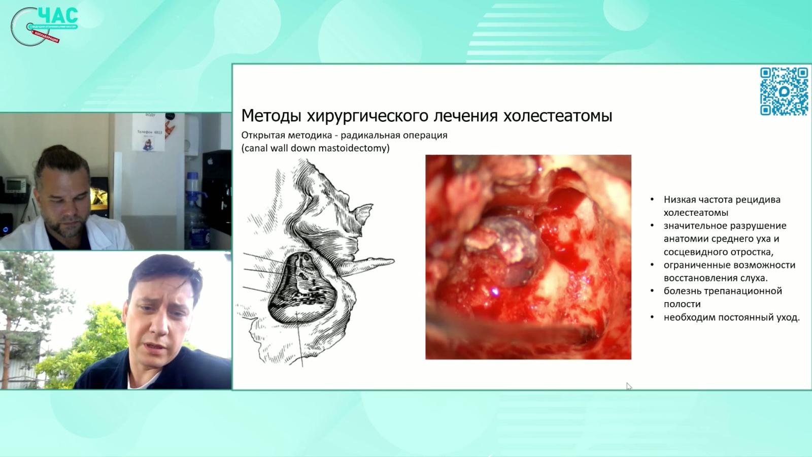 Кондратчиков Д.С., Полев Г.А. - Хирургия холестеатом у детей