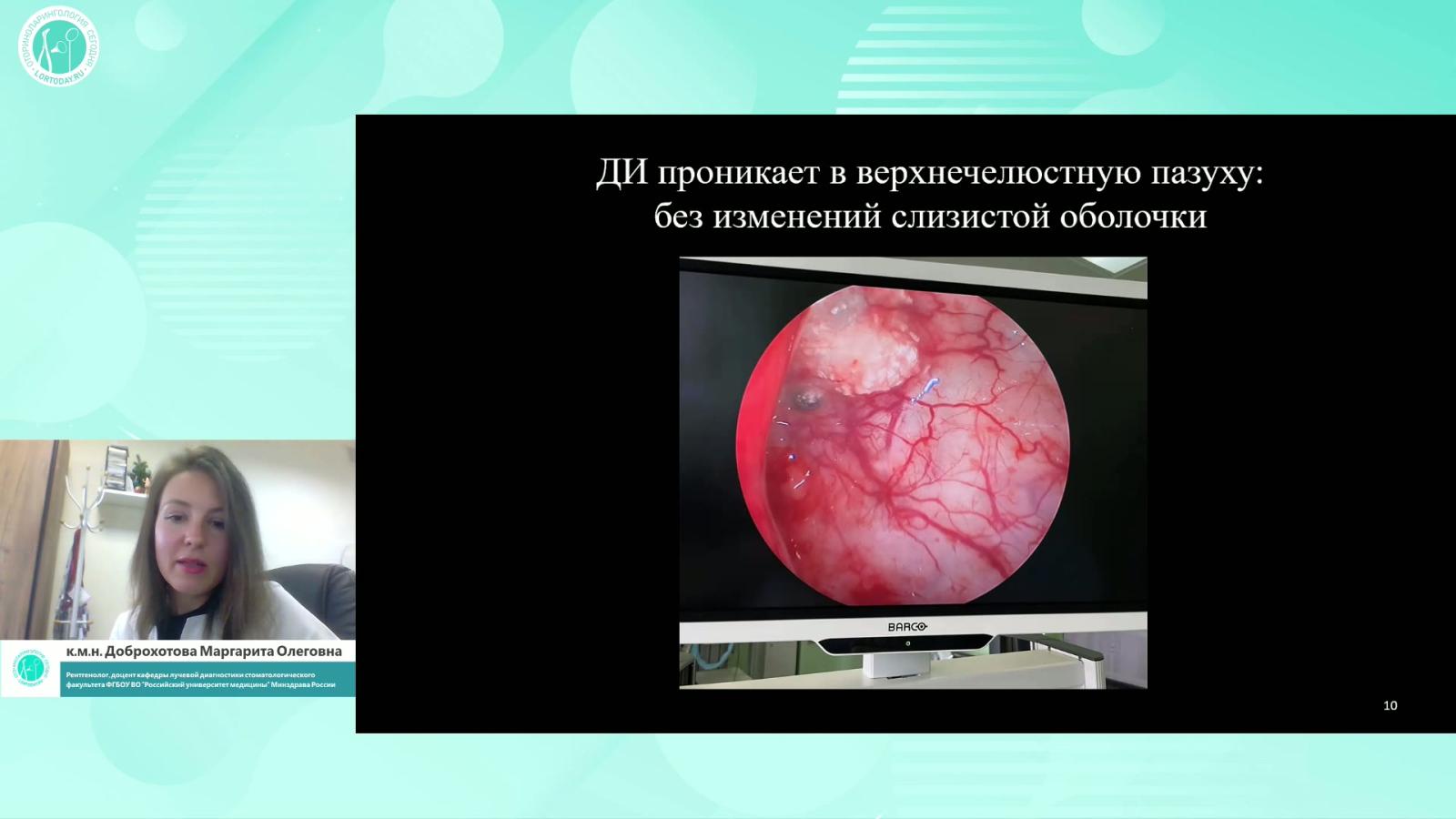 Доброхотова М.О. - Оториноларингологические осложнения дентальной имплантации